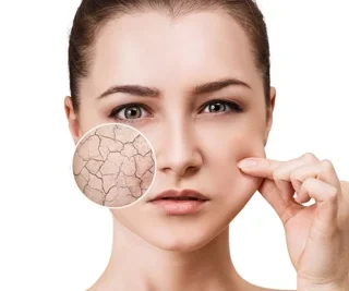 راهنمای انواع پوست
